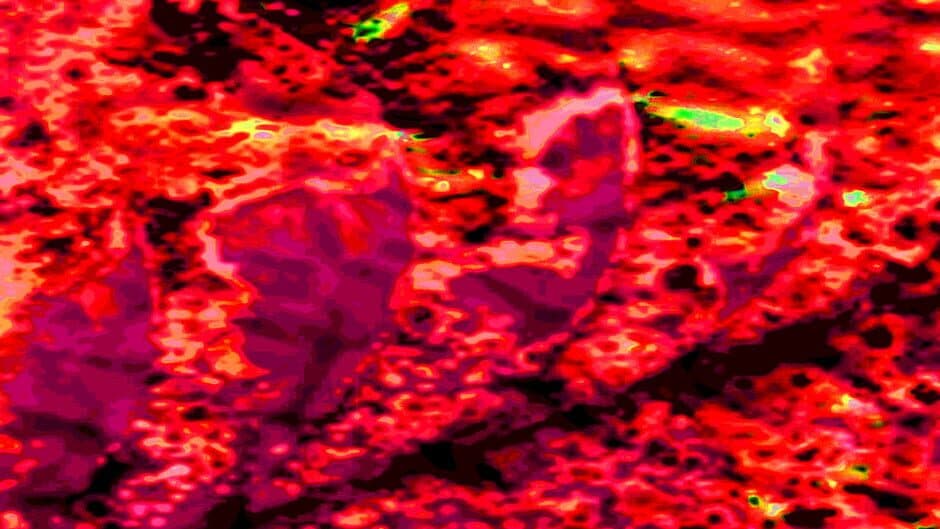 Neurospasm artwork 1