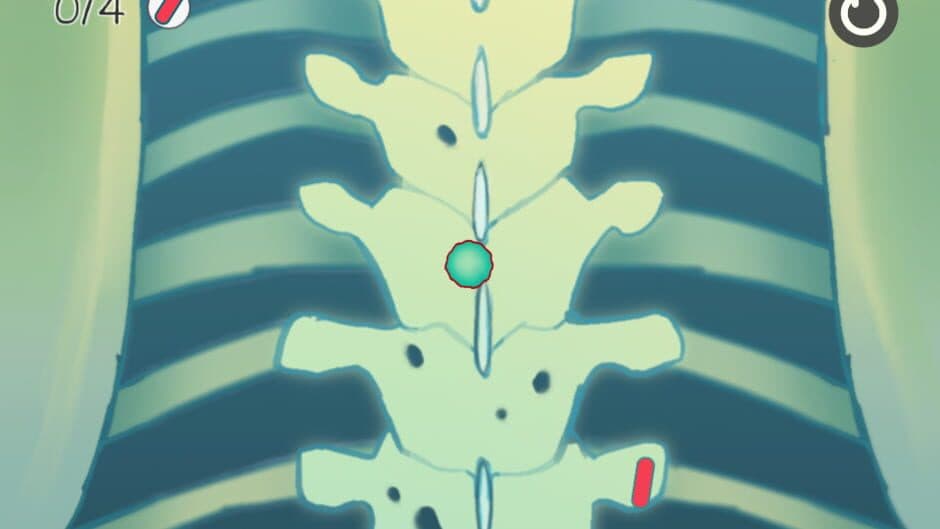 Grey Plague screenshot 2